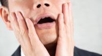 ヒゲ脱毛に失敗して後悔する男性
